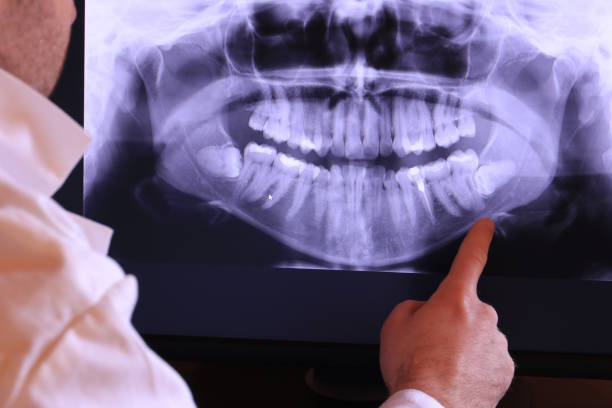 Best Chipped Tooth Repair Near Me  in Grand Mound, WA