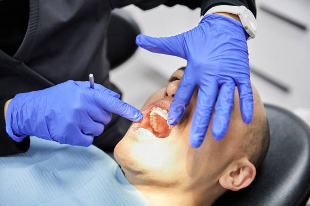 Best Broken Tooth Emergency  in Grand Mound, WA